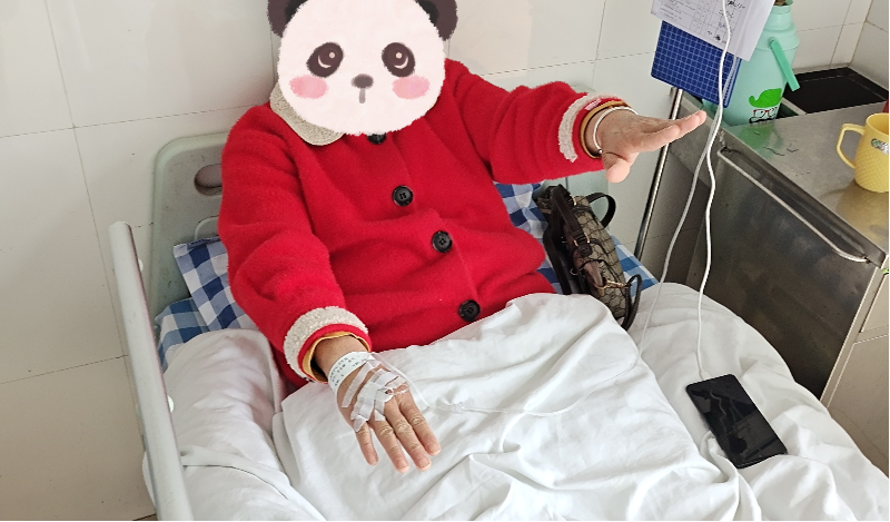 患者入院时右侧肢体乏力（溶栓前）.png